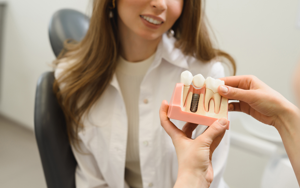 Dental Implants Perth and its Benefits