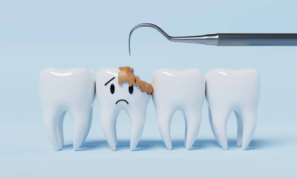 How Do You Know if Your Tooth is Rotten?